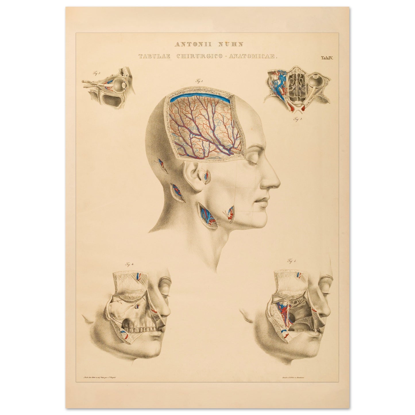 Planche anatomique : Vue approfondie des cavités crâniennes et des artères cérébrales par Anton Nuhn - Taille 29,7x42 cm (A3)