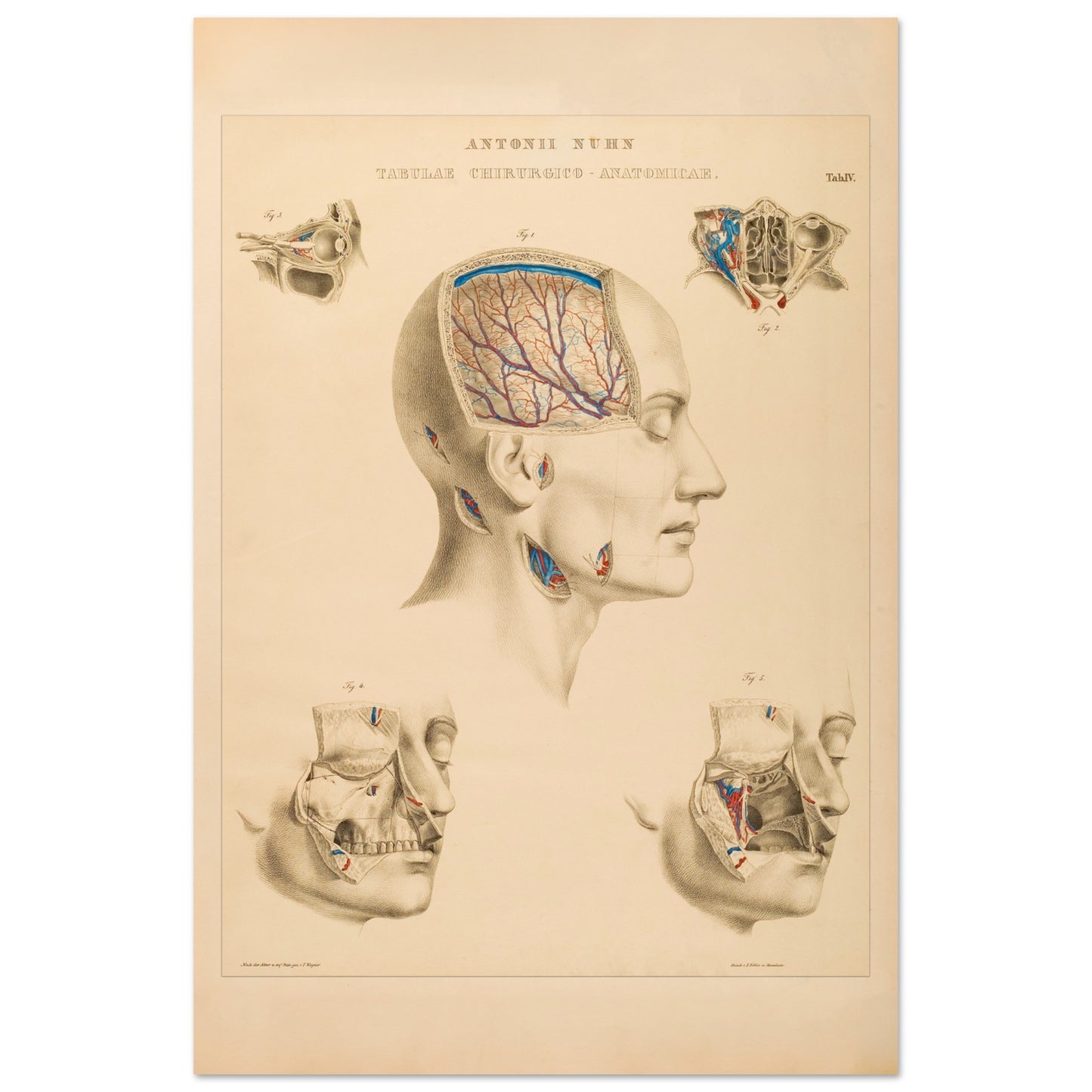Planche anatomique : Vue approfondie des cavités crâniennes et des artères cérébrales par Anton Nuhn - Taille 40x60 cm