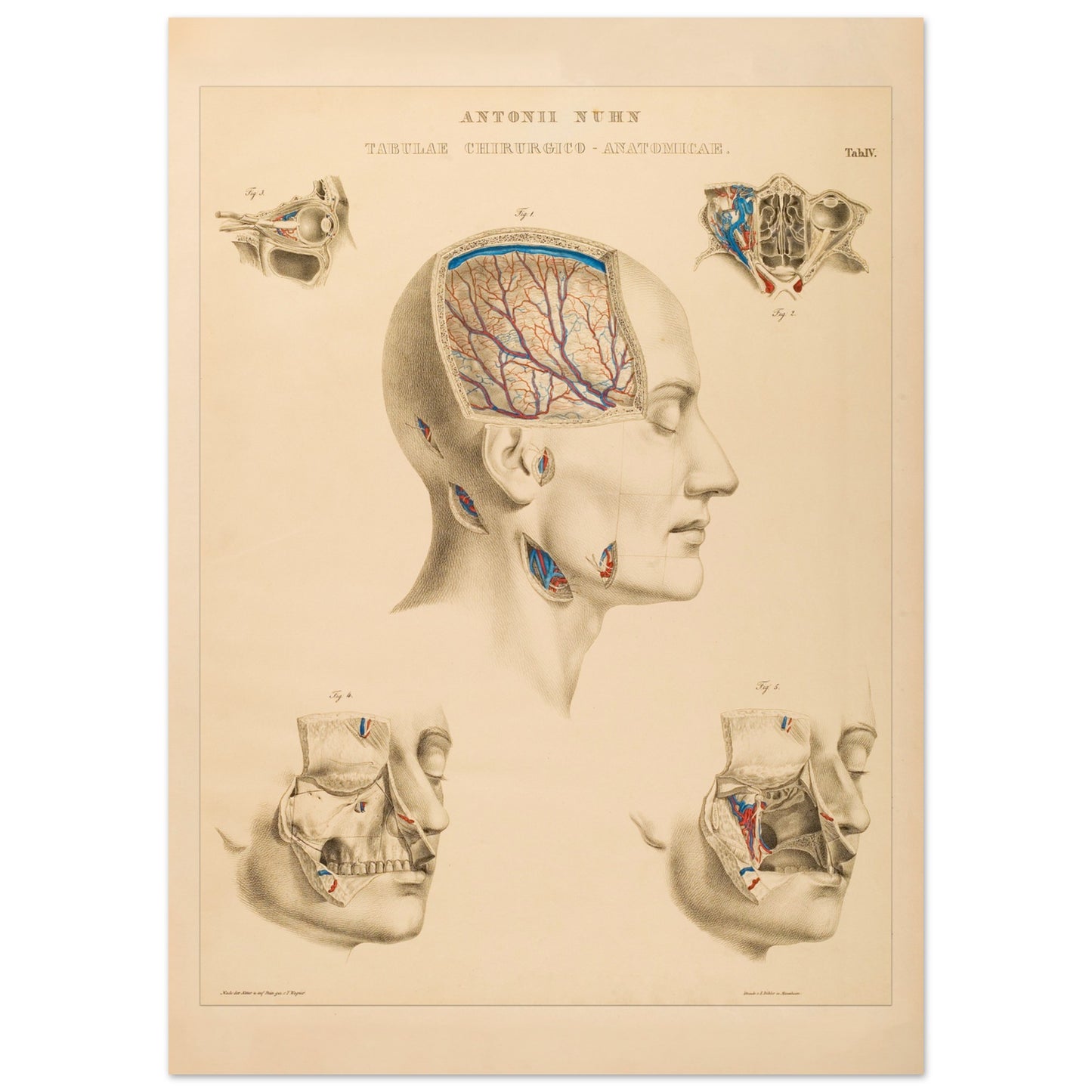 Planche anatomique : Vue approfondie des cavités crâniennes et des artères cérébrales par Anton Nuhn - Taille 50x70 cm