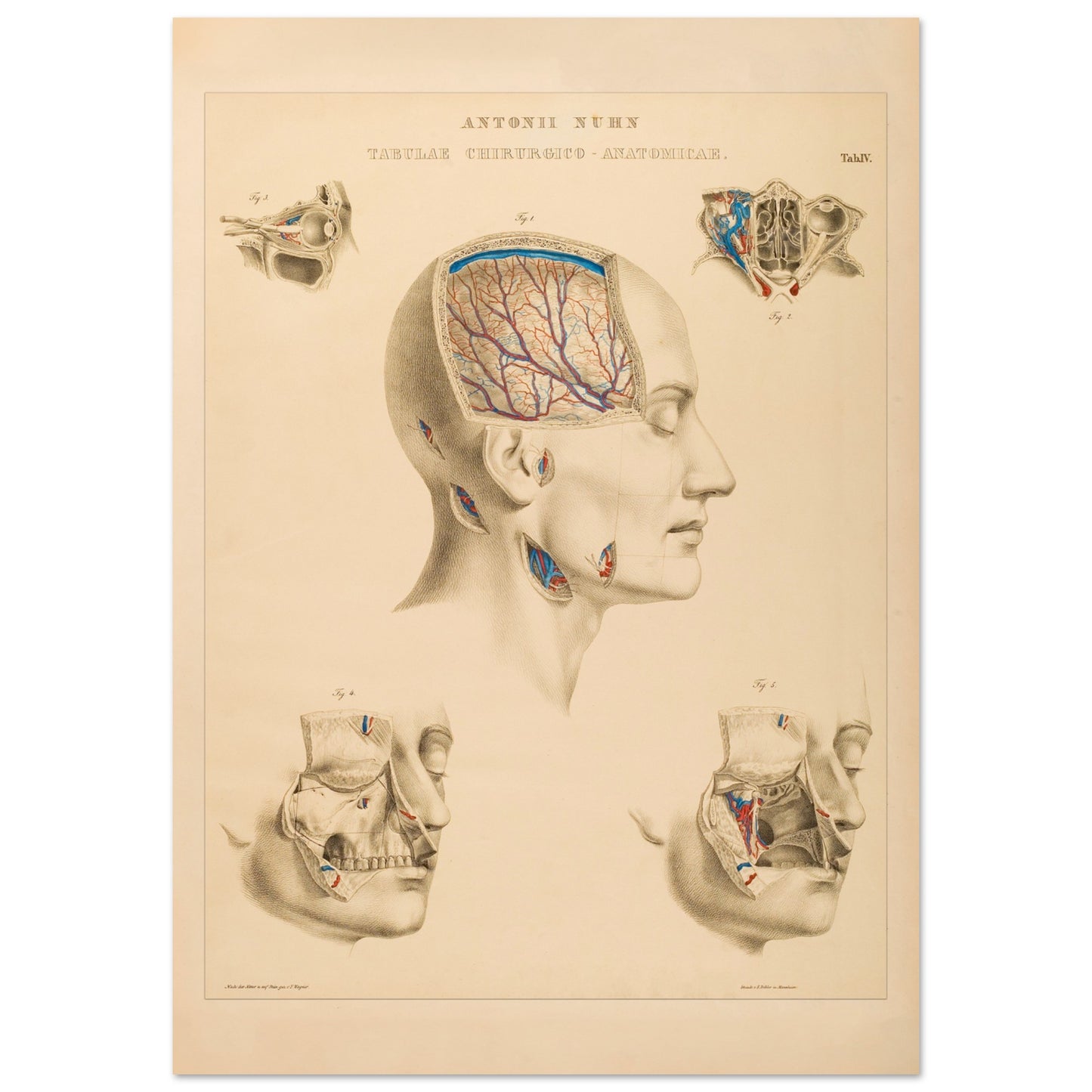 Planche anatomique : Vue approfondie des cavités crâniennes et des artères cérébrales par Anton Nuhn - Taille 59,4x84,1 cm (A1)