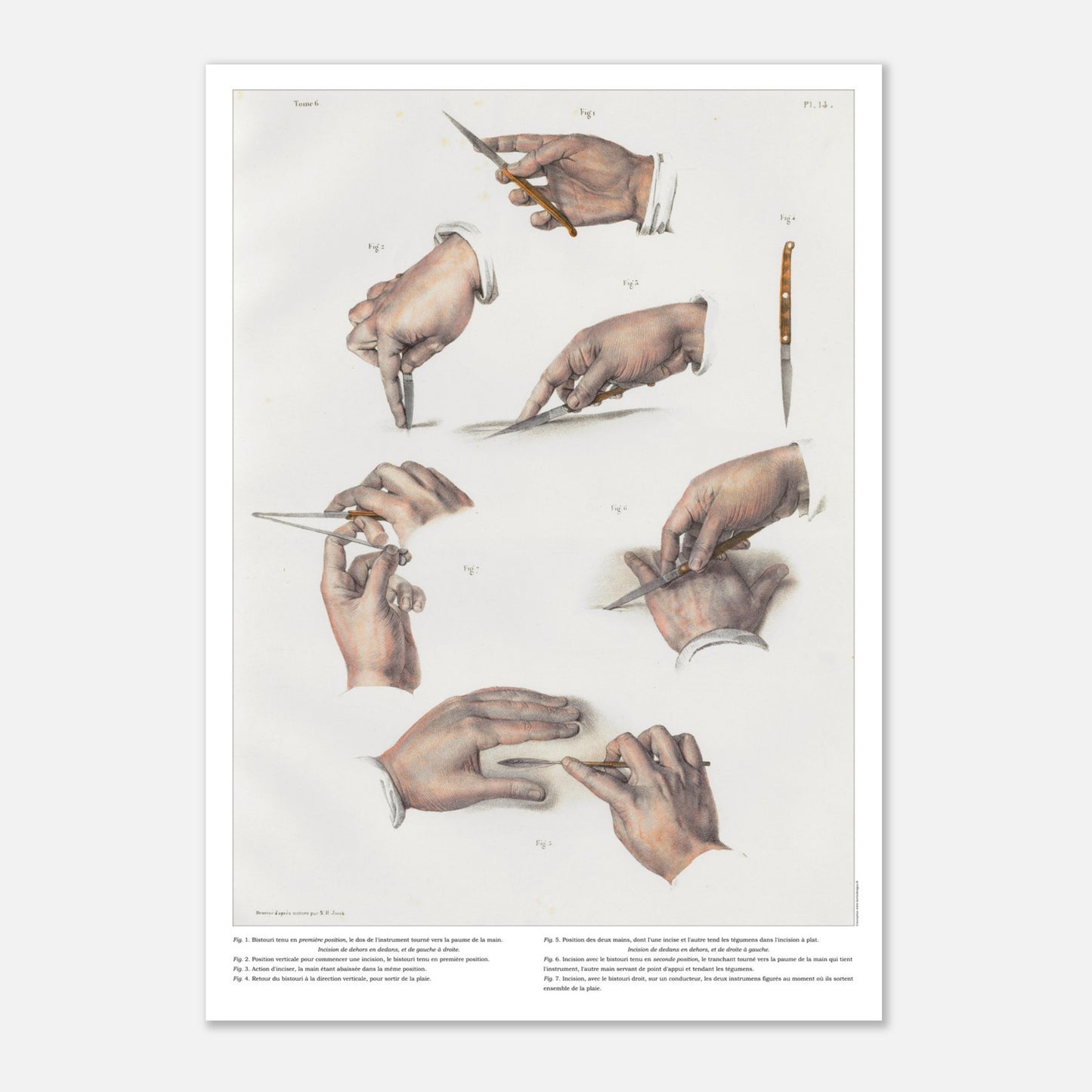 Planche d'anatomie chirurgicale - Position du bistouri et des ciseaux, techniques d'incisions - Taille 29,7x42 cm (A3)