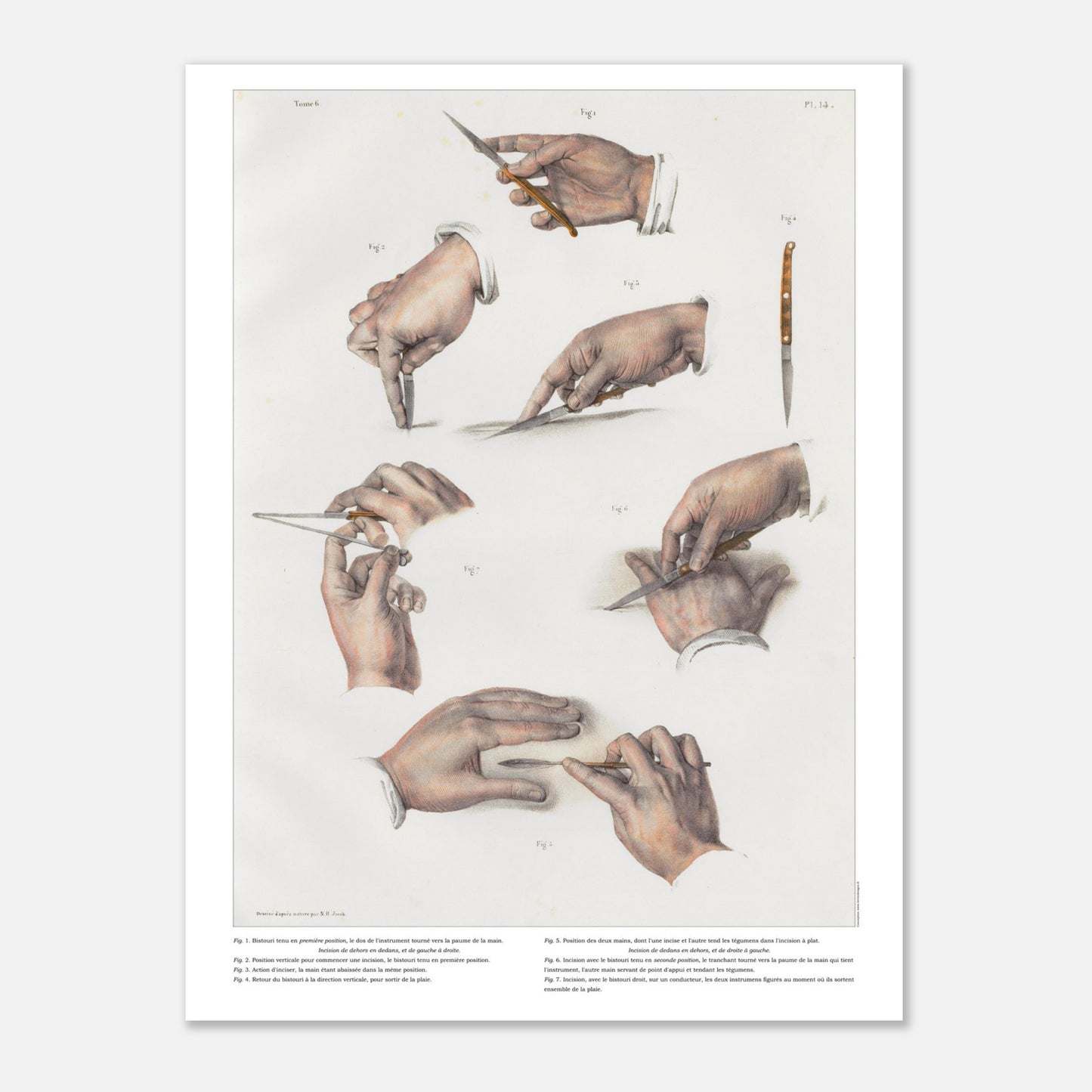 Planche d'anatomie chirurgicale - Position du bistouri et des ciseaux, techniques d'incisions - Taille 30x40 cm