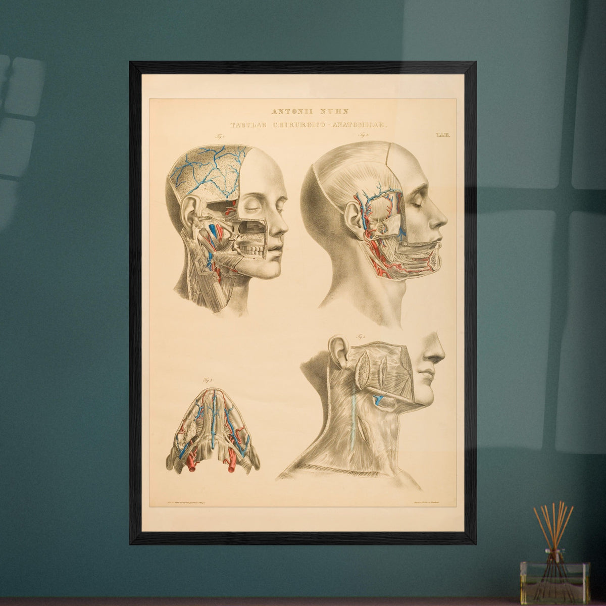 Gravure anatomique du cerveau et cavités crâniennes Anton Nuhn. Planche anatomique gravée par Anton Nuhn, offrant une vue détaillée des cavités crâniennes et des vaisseaux sanguins du cerveau.