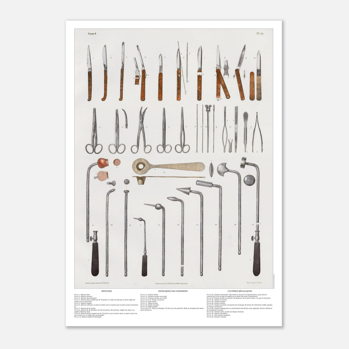 Illustration ancienne d'instruments de chirurgie et cautères (29,7x42 cm (A3)). Planche d'instruments chirurgicaux anciens, incluant divers bistouris, ciseaux, pinces et cautères métalliques.