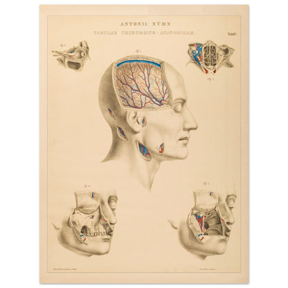 Planche chirurgicale de la tête humaine par Anton Nuhn (30x40 cm). Planche anatomique chirurgicale montrant des coupes de la tête humaine, illustrant les cavités crâniennes, les artères cérébrales et les structures faciales.