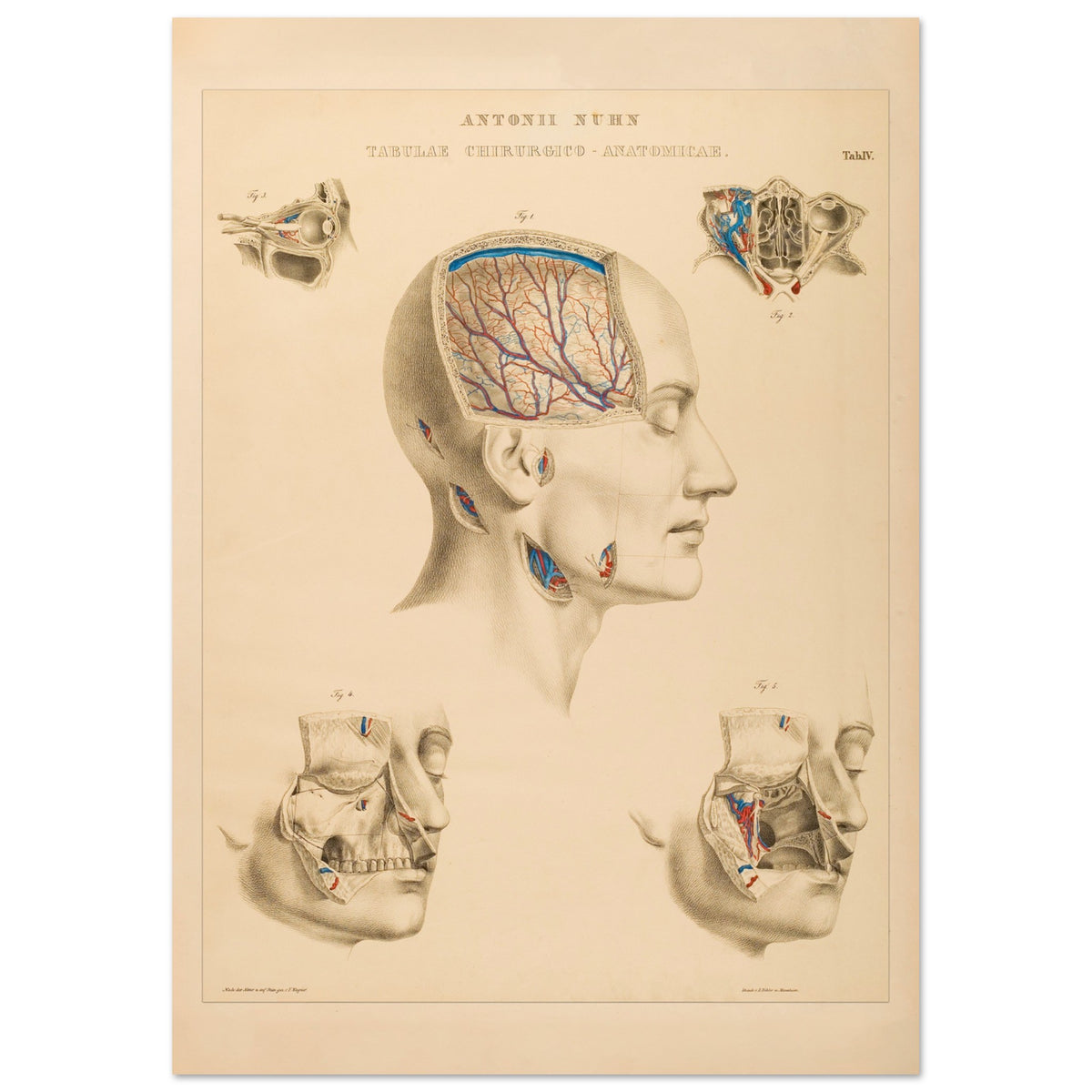 Planche chirurgicale de la tête humaine par Anton Nuhn (42x59,4 cm (A2)). Planche anatomique chirurgicale montrant des coupes de la tête humaine, illustrant les cavités crâniennes, les artères cérébrales et les structures faciales.