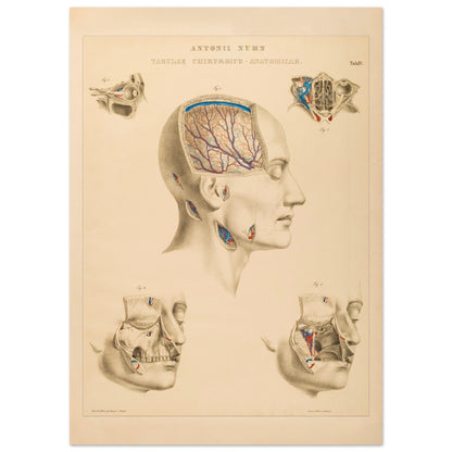 Planche chirurgicale de la tête humaine par Anton Nuhn (50x70 cm). Planche anatomique chirurgicale montrant des coupes de la tête humaine, illustrant les cavités crâniennes, les artères cérébrales et les structures faciales.