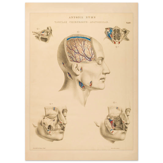 Planche chirurgicale de la tête humaine par Anton Nuhn (50x70 cm). Planche anatomique chirurgicale montrant des coupes de la tête humaine, illustrant les cavités crâniennes, les artères cérébrales et les structures faciales.
