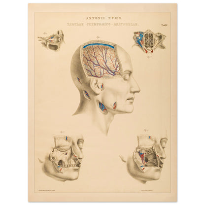 Planche chirurgicale de la tête humaine par Anton Nuhn (60x80 cm). Planche anatomique chirurgicale montrant des coupes de la tête humaine, illustrant les cavités crâniennes, les artères cérébrales et les structures faciales.