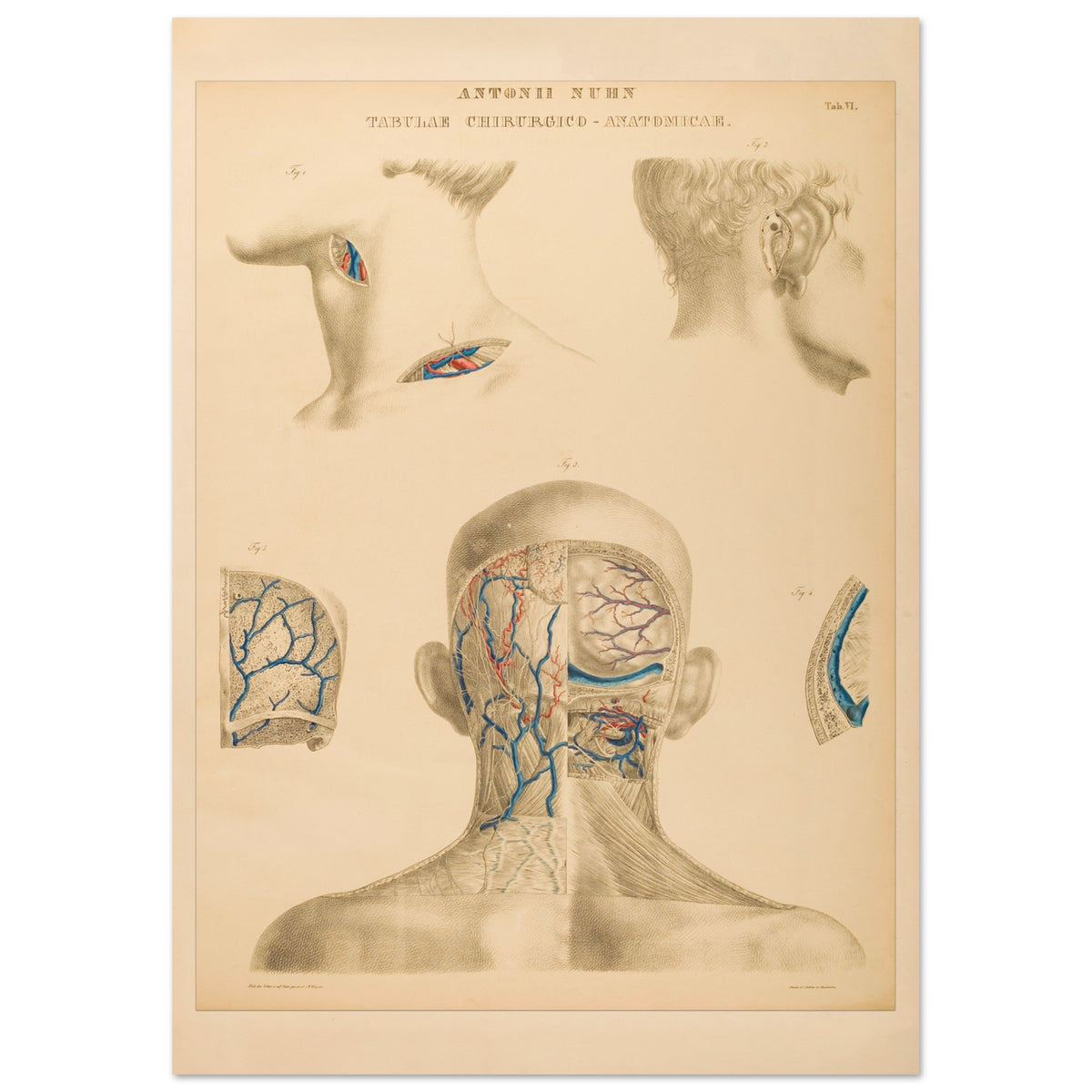 Planche anatomique occipitale et mastoïdienne Anton Nuhn (21x29,7 cm (A4)). Planche anatomique chirurgicale de la région occipitale et mastoïdienne, montrant les structures vasculaires et osseuses, par Anton Nuhn.