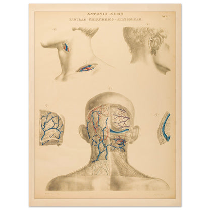 Planche anatomique occipitale et mastoïdienne Anton Nuhn (30x40 cm). Planche anatomique chirurgicale de la région occipitale et mastoïdienne, montrant les structures vasculaires et osseuses, par Anton Nuhn.