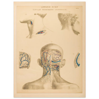 Planche anatomique occipitale et mastoïdienne Anton Nuhn (60x80 cm). Planche anatomique chirurgicale de la région occipitale et mastoïdienne, montrant les structures vasculaires et osseuses, par Anton Nuhn.