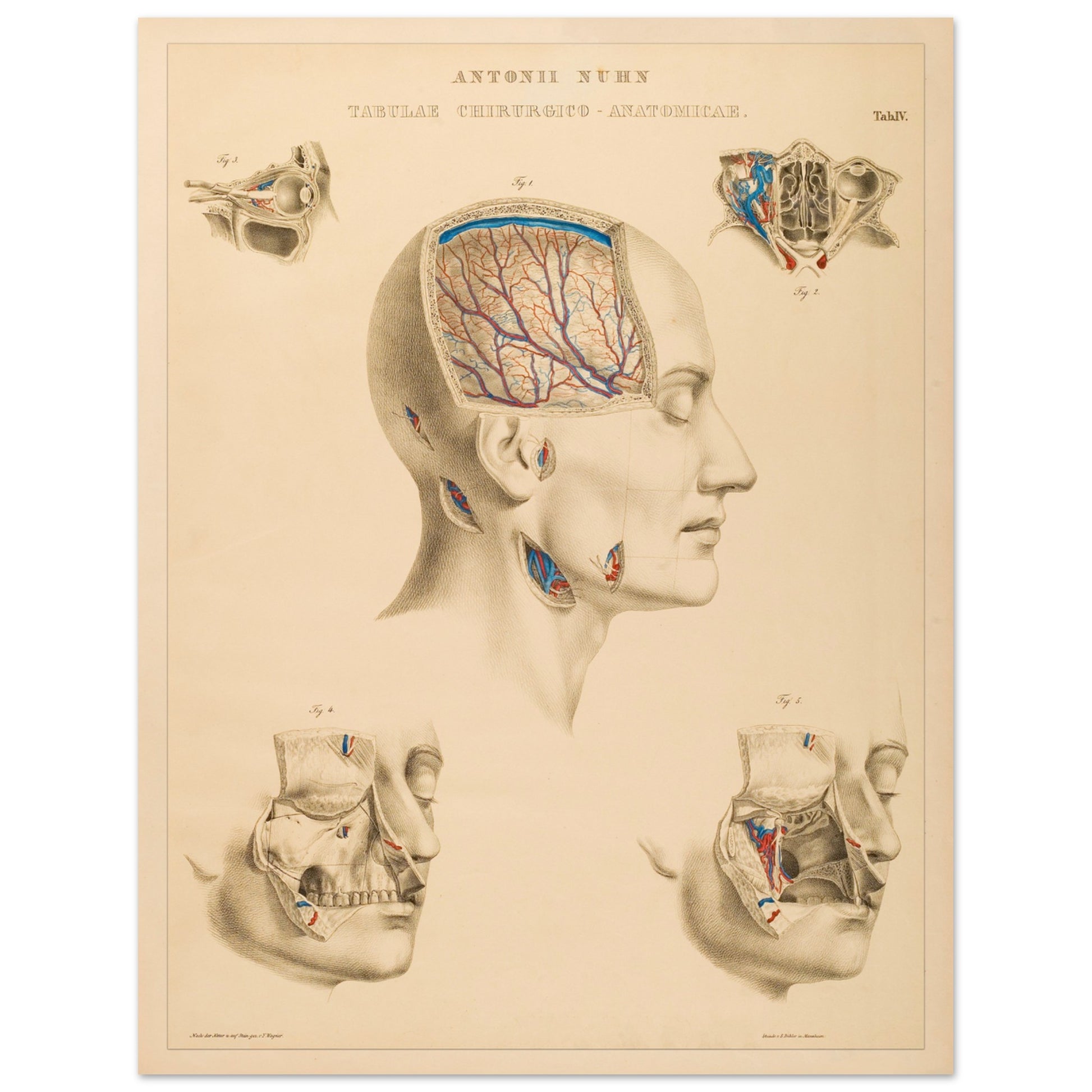 Planche anatomique : Vue approfondie des cavités crâniennes et des artères cérébrales par Anton Nuhn - Taille 27x35 cm