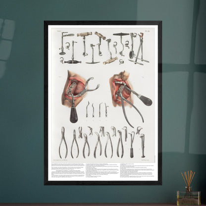 Planche d'odontologie ancienne et instruments dentaires. Planche anatomique chirurgicale présentant de nombreux instruments dentaires et deux vues d'une bouche en cours de traitement.